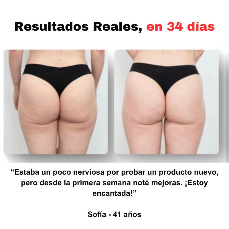 SmoothGlow™ - Masajeador anticelulítico - Dexvon